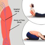 یوگا برای درد سیاتیک: 7 حرکت مؤثر برای تسکین درد در خانه